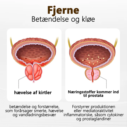 Sig farvel til ubehag i prostata Lenaro™ ProstaVibe Honey Delay Inhalator👑