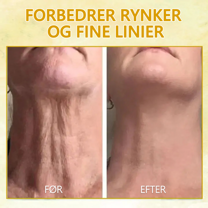 Sidste dag med rabat: 70% rabat🚀LEFUN® Skin Rejuvenating Firming Rejuvenation Oil