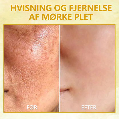 Sidste dag med rabat: 70% rabat🚀LEFUN® Skin Rejuvenating Firming Rejuvenation Oil